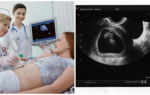 Размеры плода на узи на 8 неделе беременности: фото, особенности диагностики