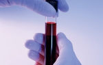 Алт в анализе крови: что это такое, норма показателей у женщин и мужчин