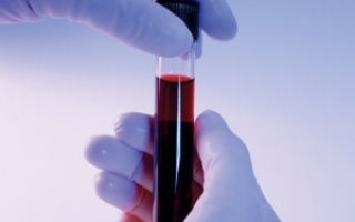 Алт в анализе крови: что это такое, норма показателей у женщин и мужчин