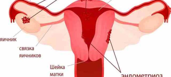 Лапароскопия: что это такое, отзывы, как делается и проходит операция, видео