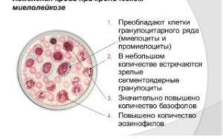 Метамиелоциты в крови: что это значит, причины и лечение повышенного уровня