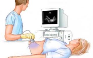 Узи на 22 неделе беременности: фото, особенности, показания и подготовка