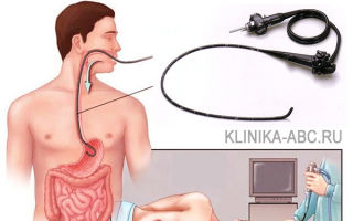 Отличия эгдс и фгдс, в чем разница эзофагогастродуоденоскопии и фиброгастродуоденоскопии