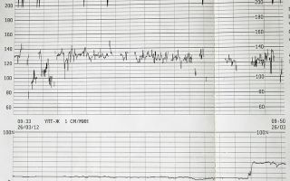 Ктг 7 баллов: что это значит, сроки и периодичность