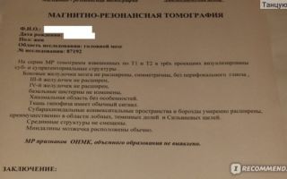 Как сделать мрт при клаустрофобии, способы пройти магнитно-резонансную томографию