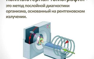 Мрт позвоночника и спины, что показывает магнитно-резонансная томография