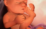 Определение пола ребенка на узи на 20 неделе беременности, фото