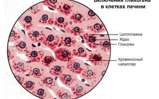 Низкий сахар в крови: причины пониженного уровня, что это значит, симптомы, что делать