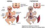 Доплер узи при беременности: что это такое, подготовка к доплерографии плода