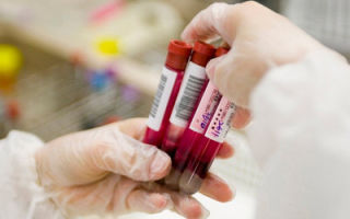 Rdw в анализе крови: что это такое, почему бывает повышен, расшифровка и норма у женщин