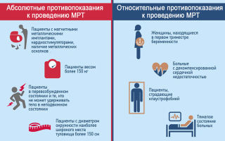 Мрт малого органов малого таза и тазобедренных суставов: что показывает, отзывы