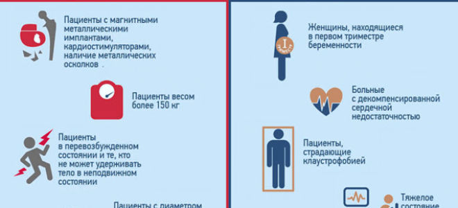 Мрт малого органов малого таза и тазобедренных суставов: что показывает, отзывы