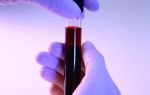 Lym в анализе крови: что это такое, норма лимфоцитов в крови у женщин, мужчин