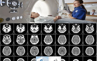 Что такое мрт: как проводится магнитно-резонансная томография, принцип действия диагностики