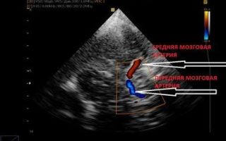 Допплерография (дуплексное сканирование): уздг вен, сканирование узи с доплером
