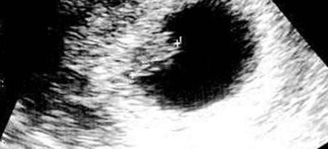 Узи на 7 неделе беременности: размеры плода на диагностике, фото
