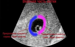 На каком сроке можно определить пол ребенка на узи при беременности