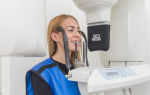 3д рентген зубов и в чем преимущества 3d диагностики