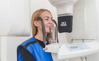 3д рентген зубов и в чем преимущества 3d диагностики