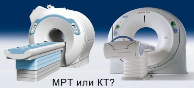 Кт и мрт головного мозга: чем отличается, что лучше и информативнее