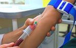 Тимоловая проба: норма у женщин и мужчин в крови, как проводят биохимический анализ