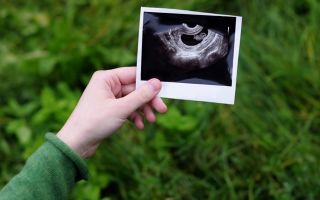 Узи на 4 неделе беременности: фото, особенности, техника проведения