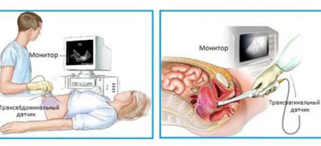 Узи женских органов, подготовка к гинекологическому исследованию мочеполовой системы (влагалища, паховой области)