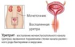 Плоский эпителий в моче у ребенка: норма, почему бывает повышен