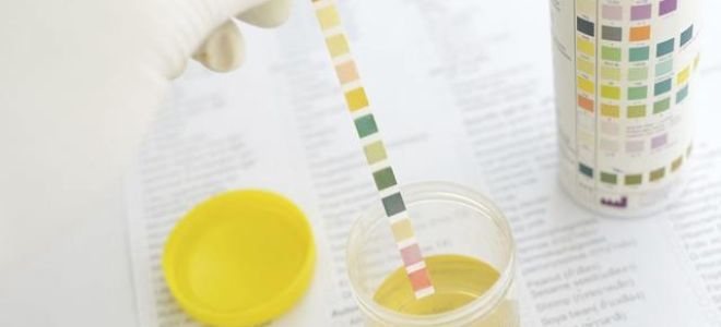 Нитриты в моче у женщин: что это значит, причины повышенного уровня у ребенка