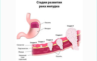 Как часто надо делать гастроскопию, через какое время можно проводить повторно