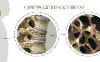 Денситометрия костей: что это такое, как проводят ультразвуковую процедуру