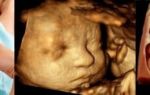 3д узи при беременности, фото и видео плода при трехмерном исследовании