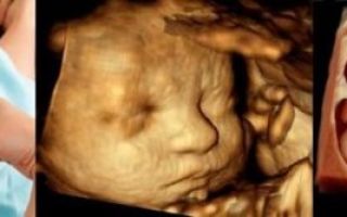 3д узи при беременности, фото и видео плода при трехмерном исследовании
