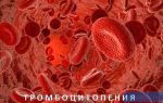 Низкие тромбоциты в крови: причины пониженного уровня, последствия у женщин, мужчин