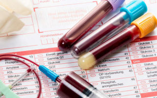 Клинический анализ крови: как сдавать, что показывает, расшифровка показателей, подготовка