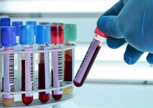 Анализ крови на РМП: что это такое, расшифровка, подготовка