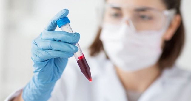 Анализ крови на РФМК: что это такое, расшифровка, почему бывает повышен