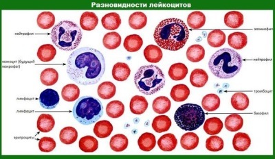 Повышены или понижены лимфоциты в крови у ребенка: причины, какая норма содержания