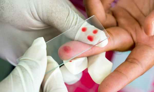 mid в анализе крови: что это такое, расшифровка, норма у женщин
