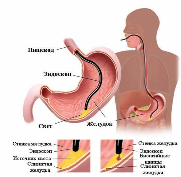 Как проверить желудок без гастроскопии: обследование, как определить кислотность