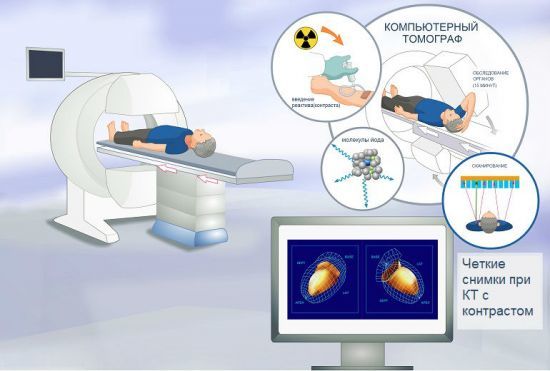 Компьютерная томография легких: что показывает, особенности, преимущества