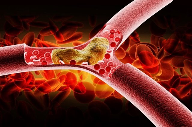 Низкий холестерин в крови у женщин и мужчин: причины понижения, что это значит