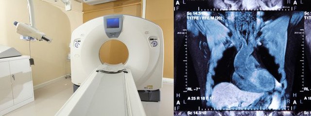 МРТ сердца и коронарных сосудов: что показывает, как делают, показания