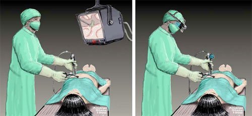 Лапароскопия брюшной полости (диагностическая): показания, подготовка