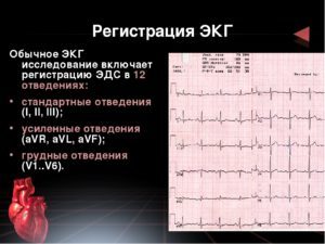 Сколько действует ЭКГ, срок годности кардиограммы сердца