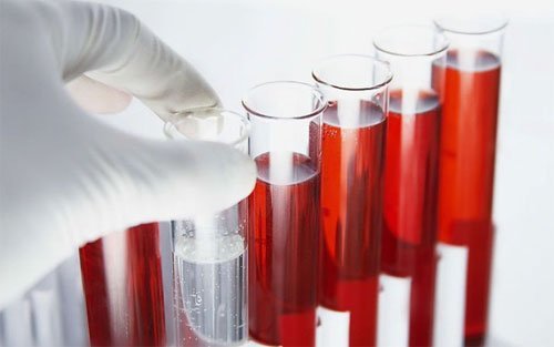Иммуноферментный анализ крови: что это такое, расшифровка исследования методом ИФА на паразитов