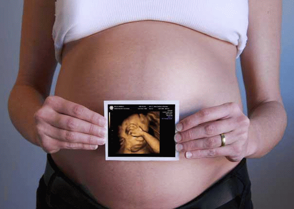УЗИ на 4 неделе беременности: фото, особенности, техника проведения
