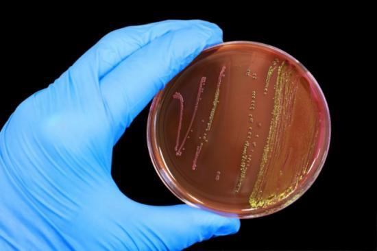escherichia coli в моче: что это такое при беременности, лечение Эшерихии коли