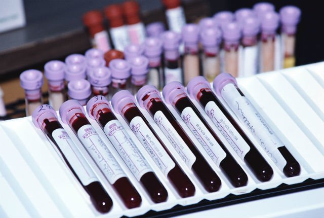Анализ крови на ПТГ: что это такое, нормы паратгормона у женщин, как правильно сдавать