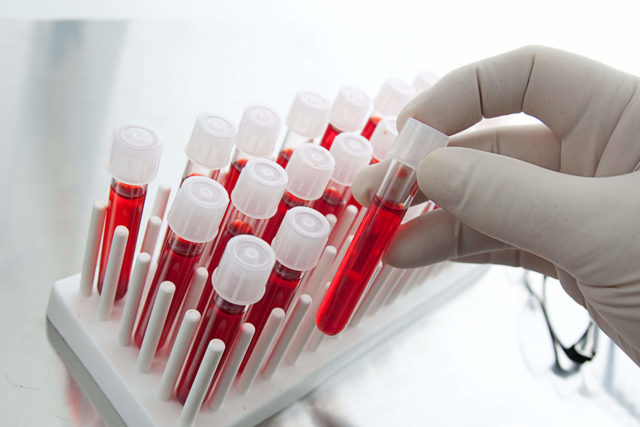 Кровь на антитела при беременности: как сдавать анализ, особенности